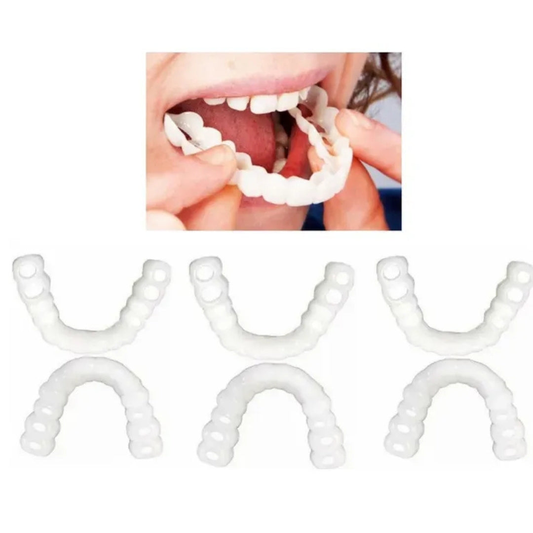 White Xpress Carillas Dentales